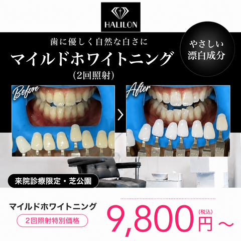 来院診療｜マイルドホワイトニングプラン(2回照射)【HALILON Oral Studio】