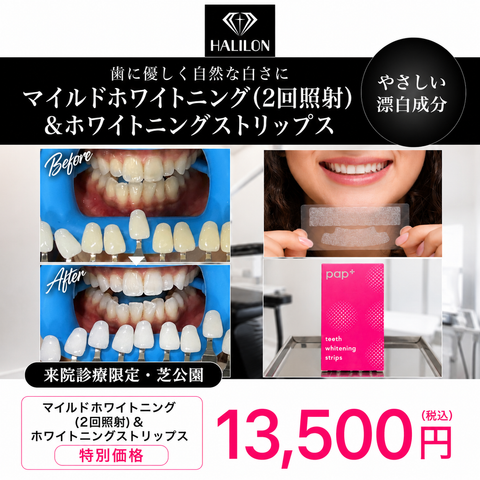 来院診療｜マイルドホワイトニングプラン(2回照射)【HALILON Oral Studio】