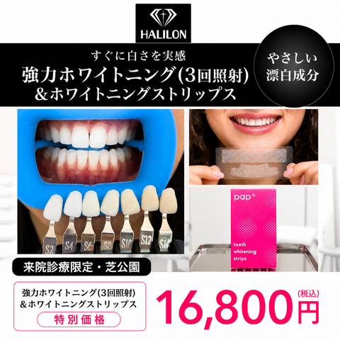 来院診療｜強力ホワイトニング(3回照射)プラン【HALILON Oral Studio】