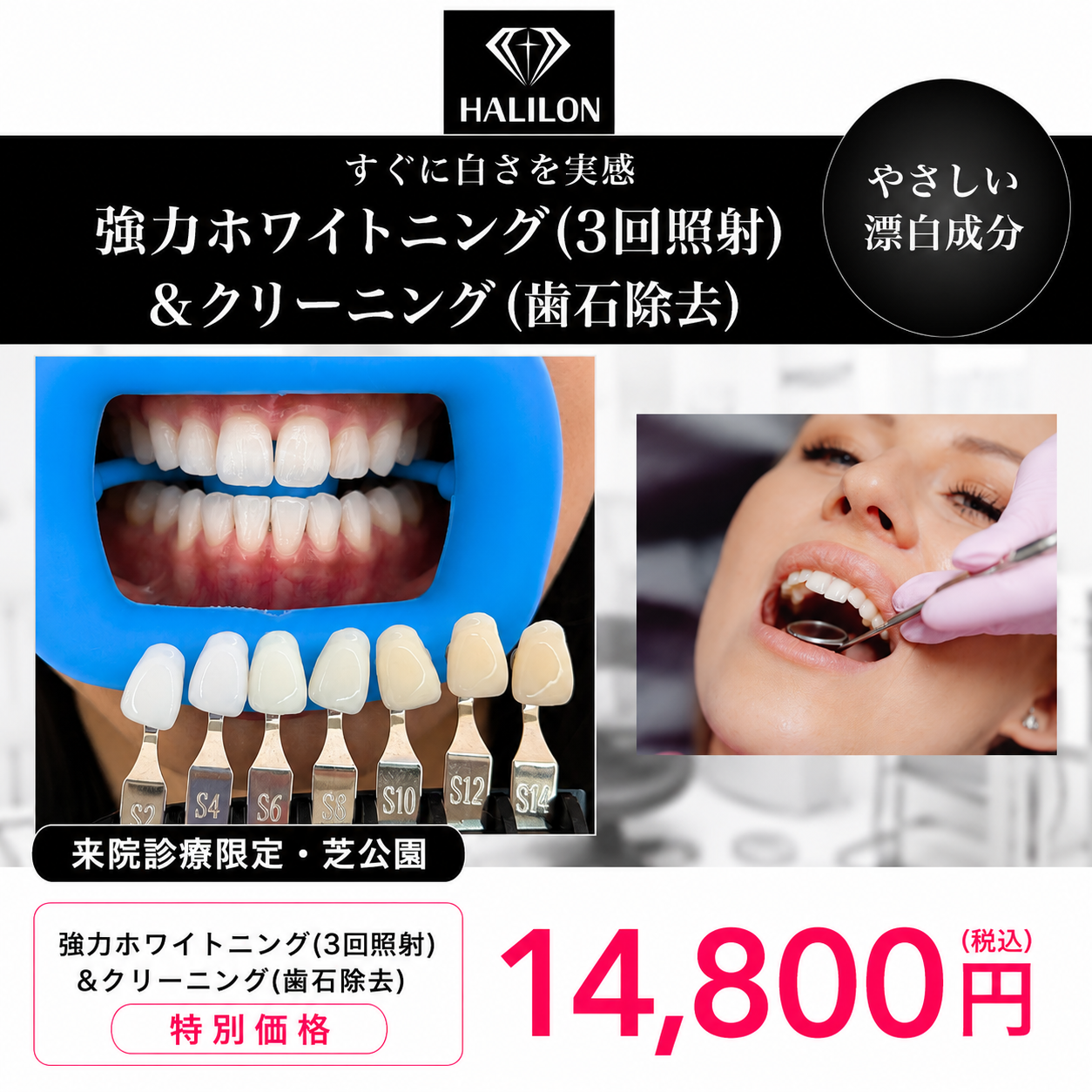 来院診療｜強力ホワイトニング(3回照射)プラン【HALILON Oral Studio】