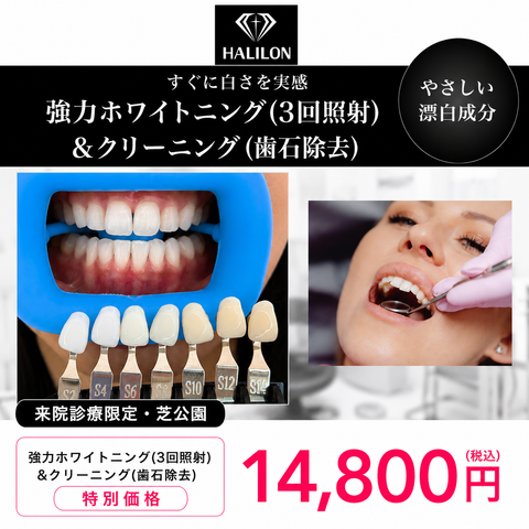 来院診療｜強力ホワイトニング(3回照射)プラン【HALILON Oral Studio】