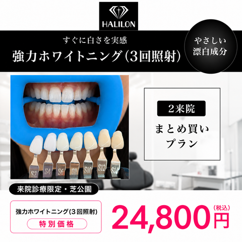 来院診療｜強力ホワイトニング(3回照射)プラン【HALILON Oral Studio】
