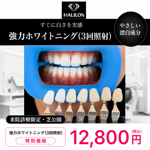 来院診療｜強力ホワイトニング(3回照射)プラン【HALILON Oral Studio】