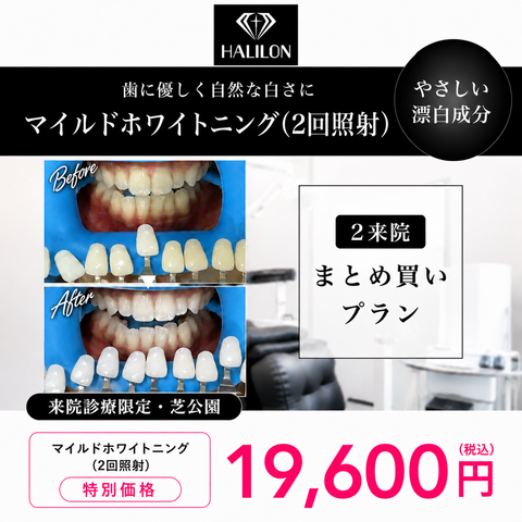 来院診療｜マイルドホワイトニングプラン(2回照射)【HALILON Oral Studio】