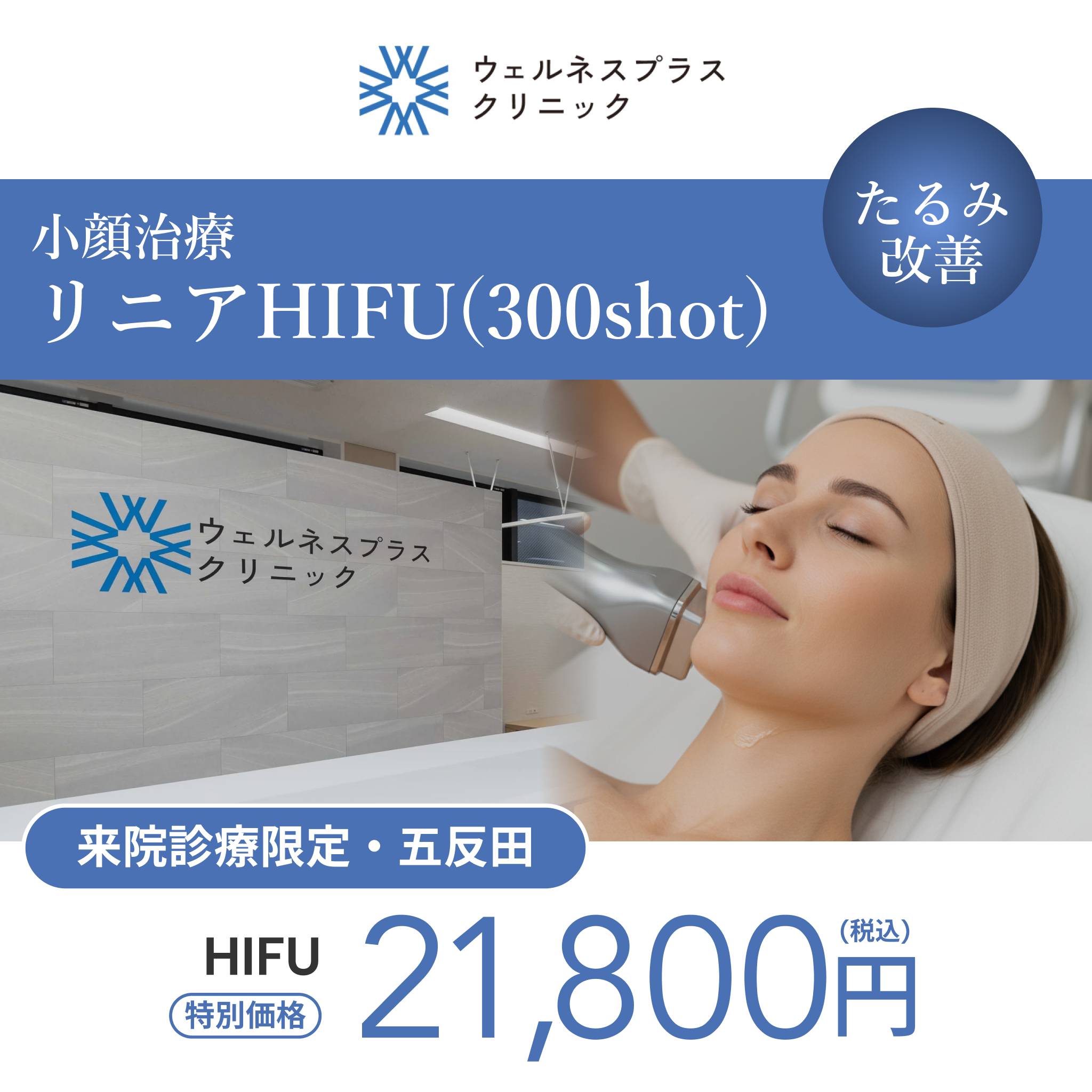 来院診療｜リニアHIFU300shot（口横・フェイスライン・顎下【Wellness Plus Clinic】