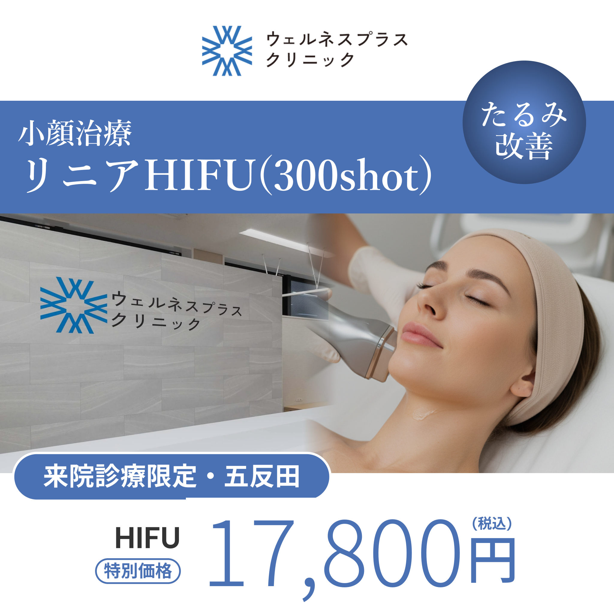 来院診療｜リニアHIFU300shot（口横・フェイスライン・顎下）【Wellness Plus Clinic】