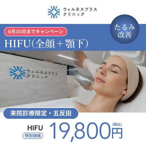 HIFU（全顔400shot＋顎下120snot）【Wellness Plus Clinic】