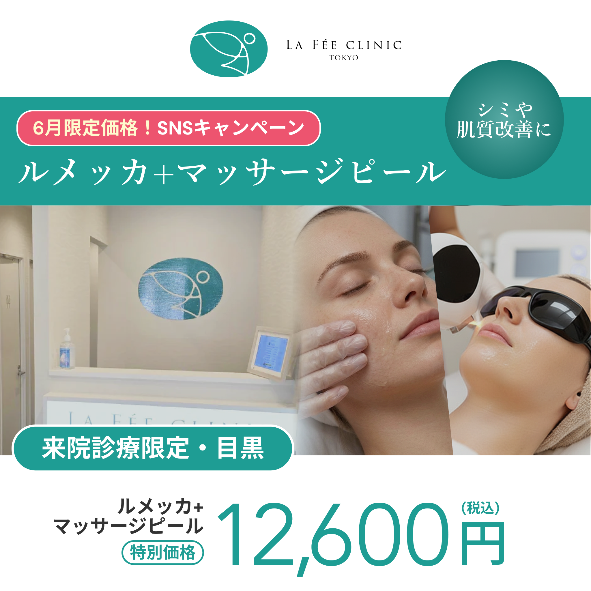 6月SNSキャンペーン｜ルメッカ＋マッサージピール【La Fée Clinic】
