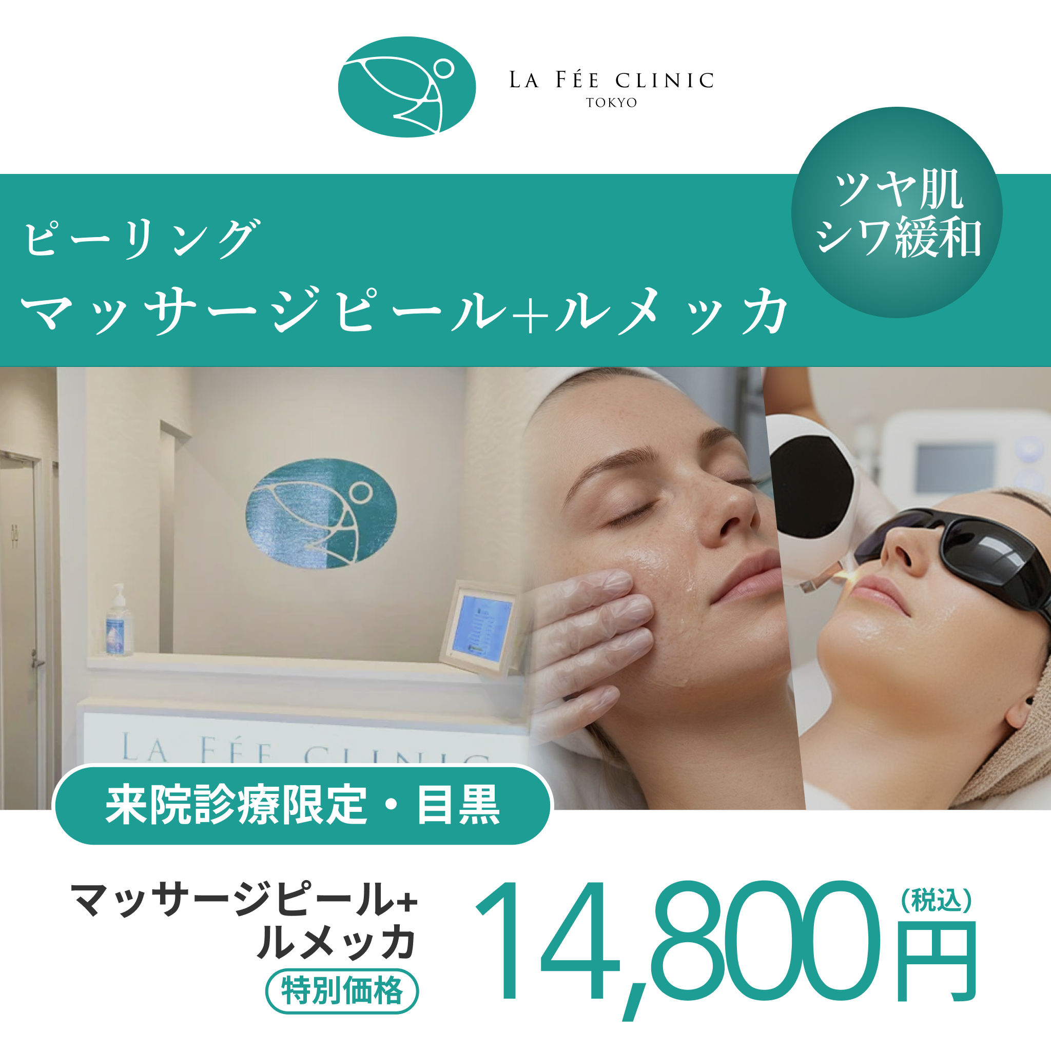 【Wellness Plus Clinic】 eCoupon | Caresys (Full Face / 1 Session)