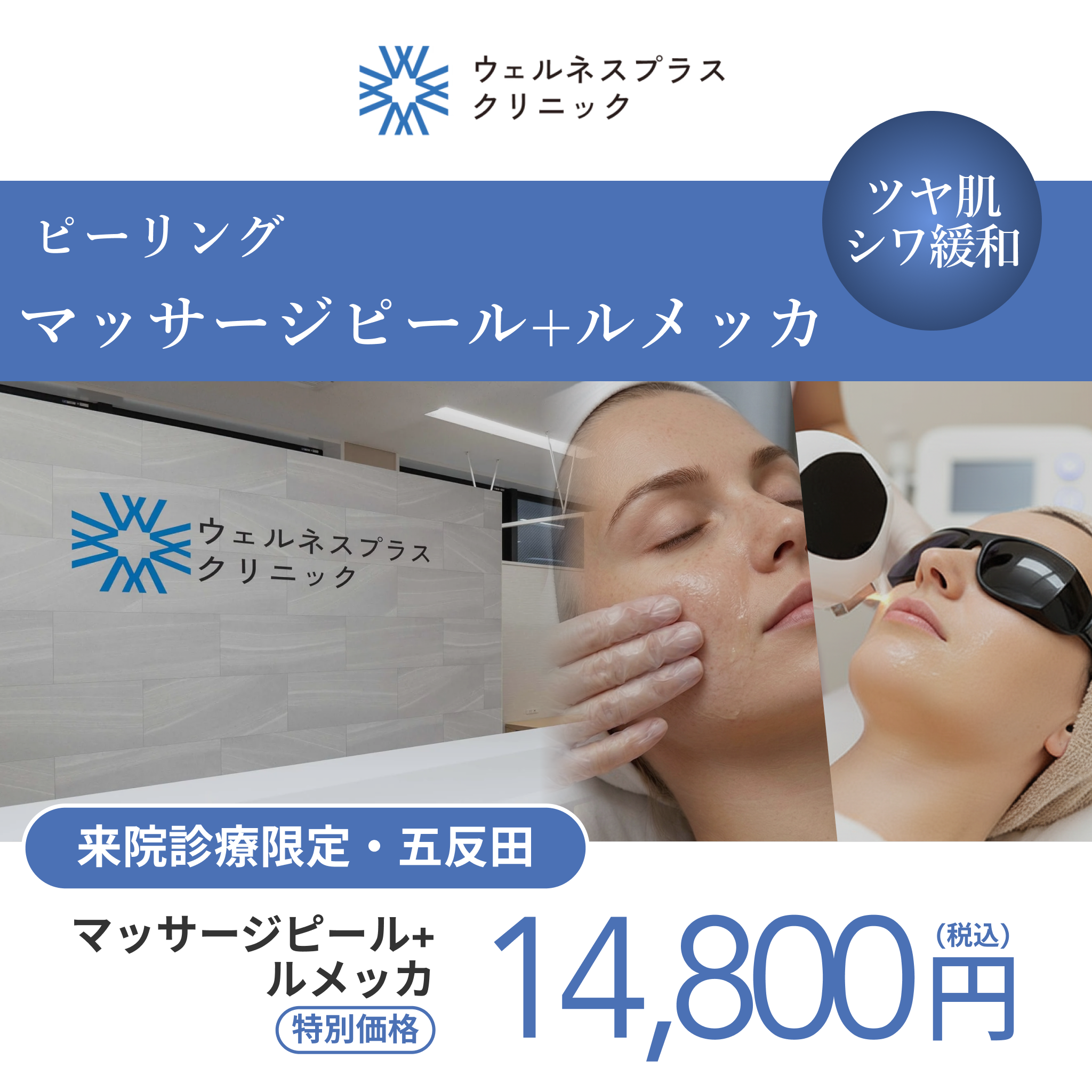 【Wellness Plus Clinic】 eCoupon | Caresys (Full Face / 1 Session)
