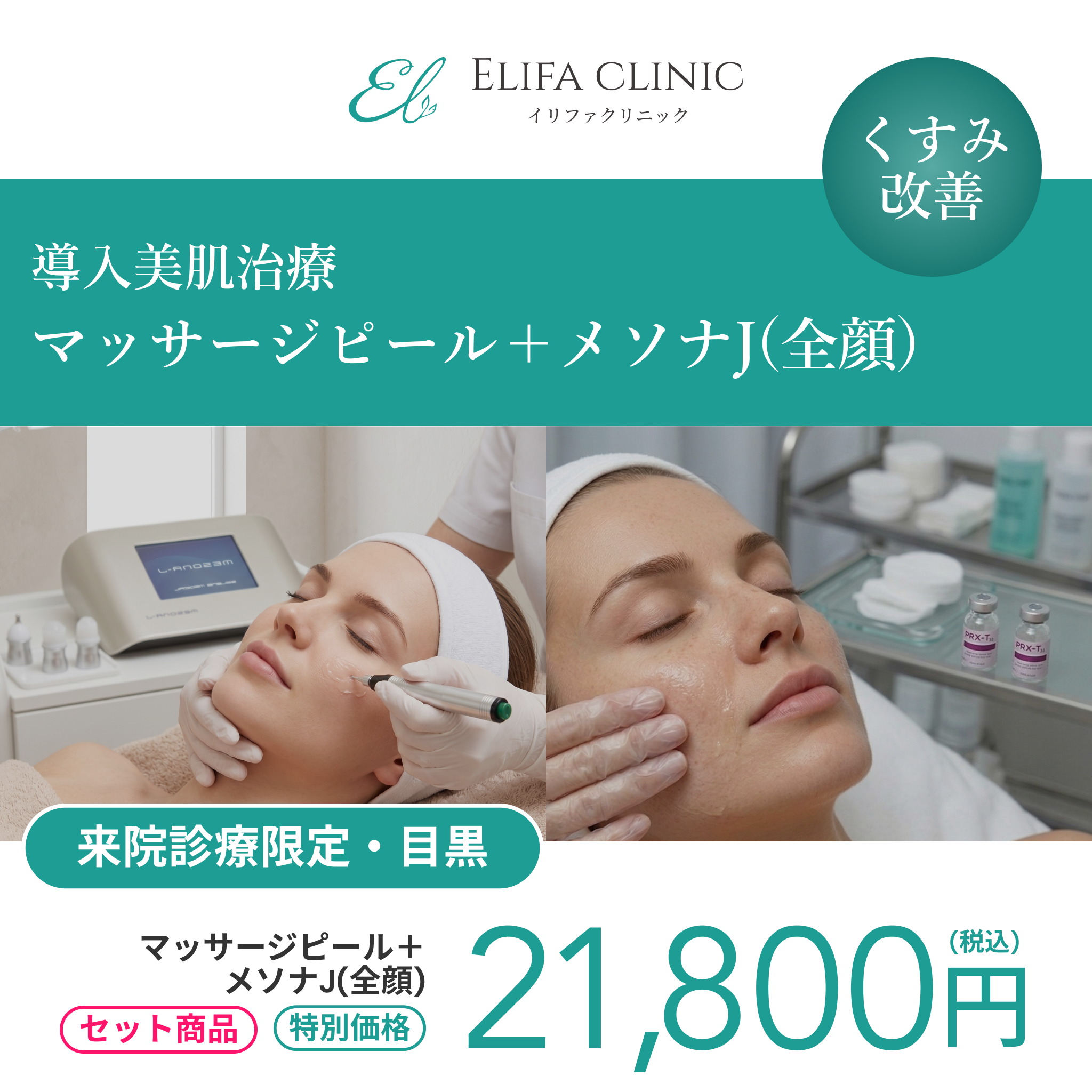 セット施術キャンペーン｜メソナJ （全顔）＋マッサージピール【Elifa Clinic】