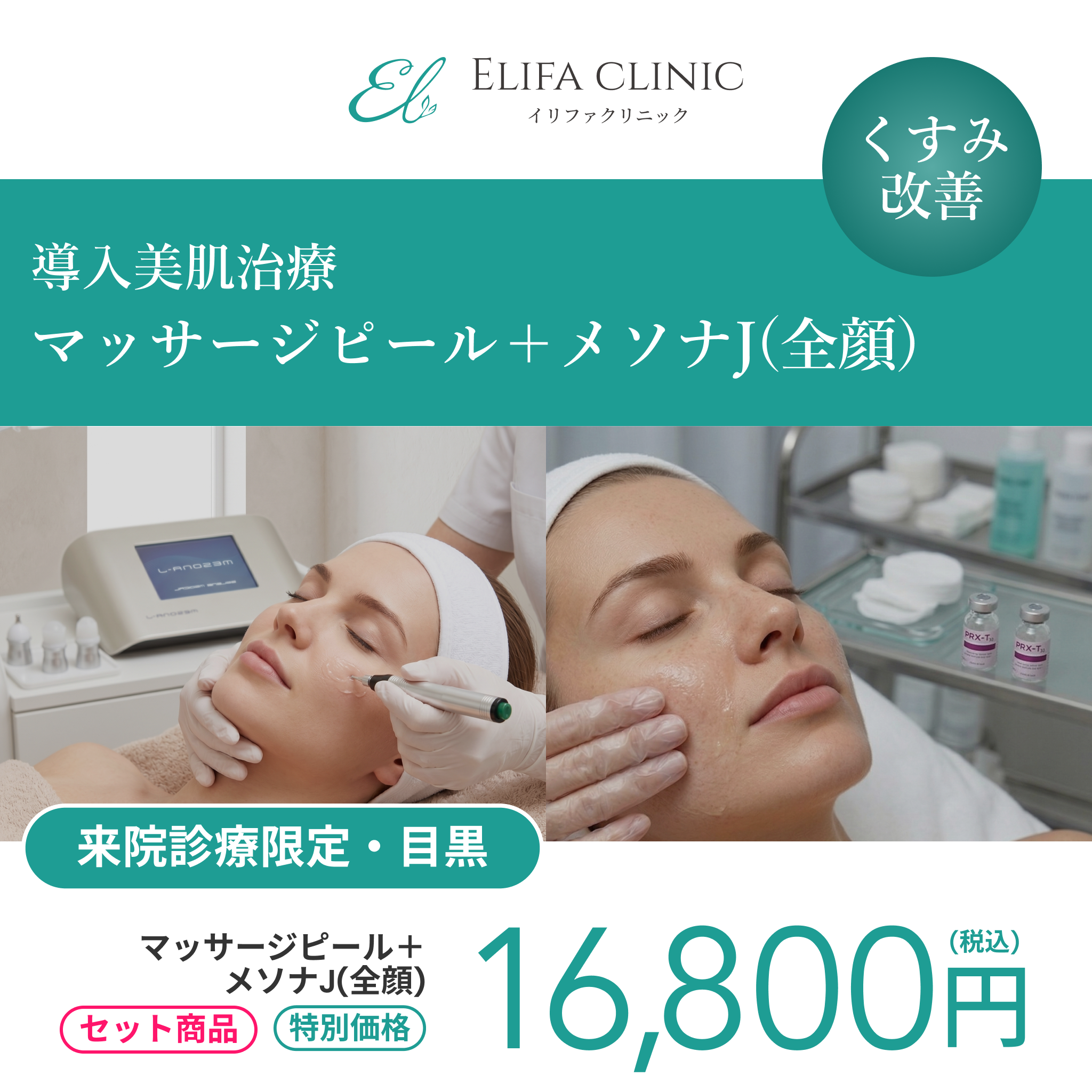 Combined treatment campaign | Mesona J (full face) + Massage Peel 【Elifa Clinic】