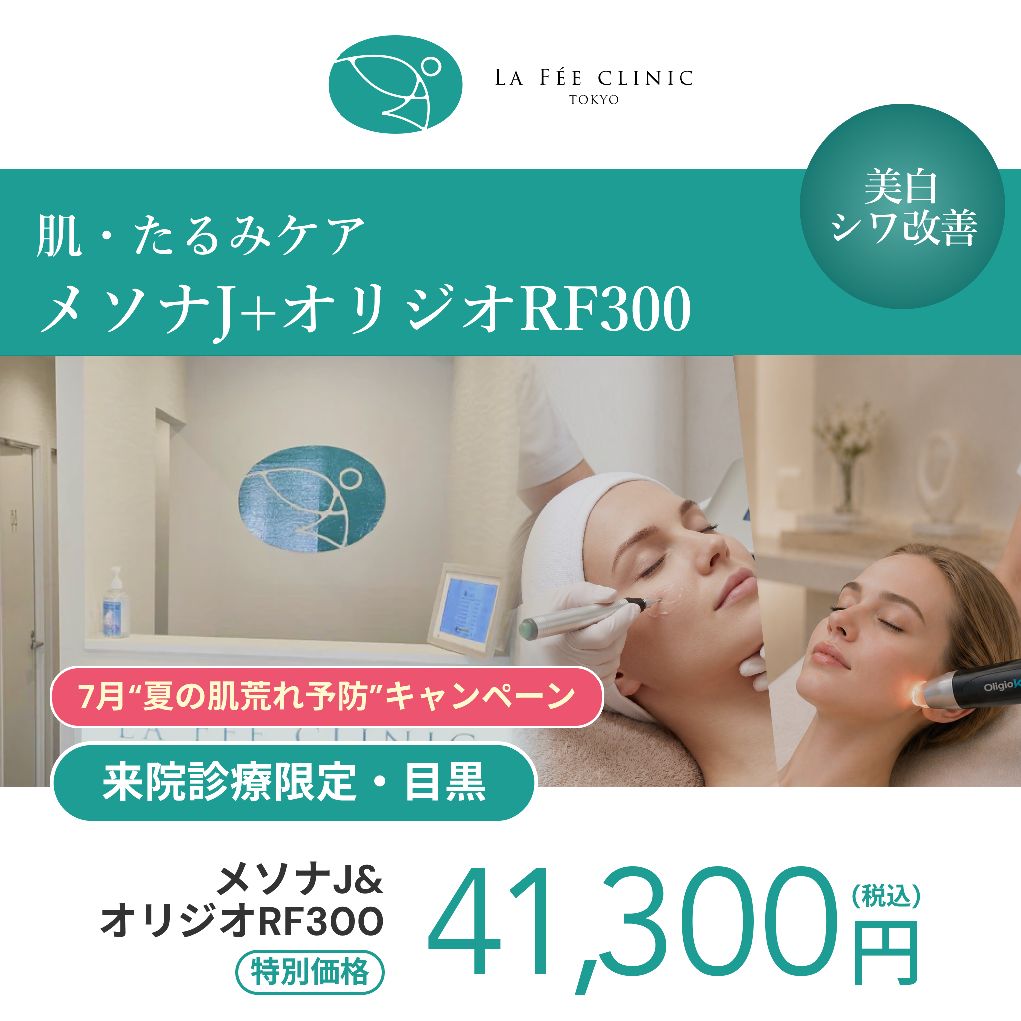 7月“夏の肌荒れ予防”キャンペーン｜オリジオRF300shot＋メソナJ【La Fée Clinic】