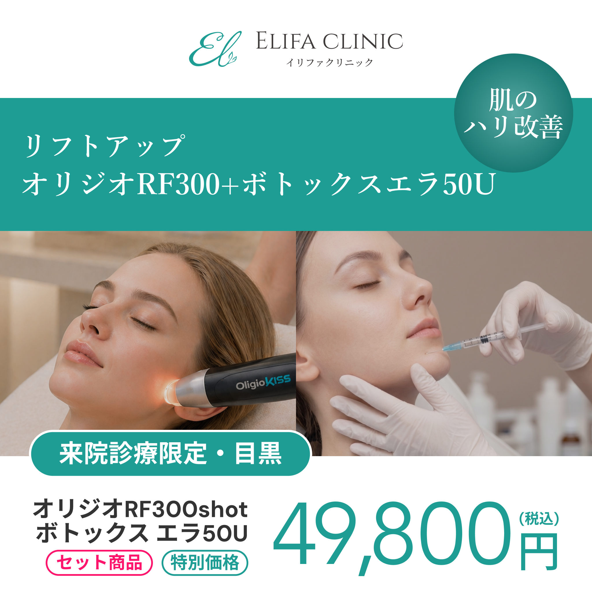 セット施術キャンペーン｜オリジオRF300shot + ボツラックス エラ50U【Elifa Clinic】