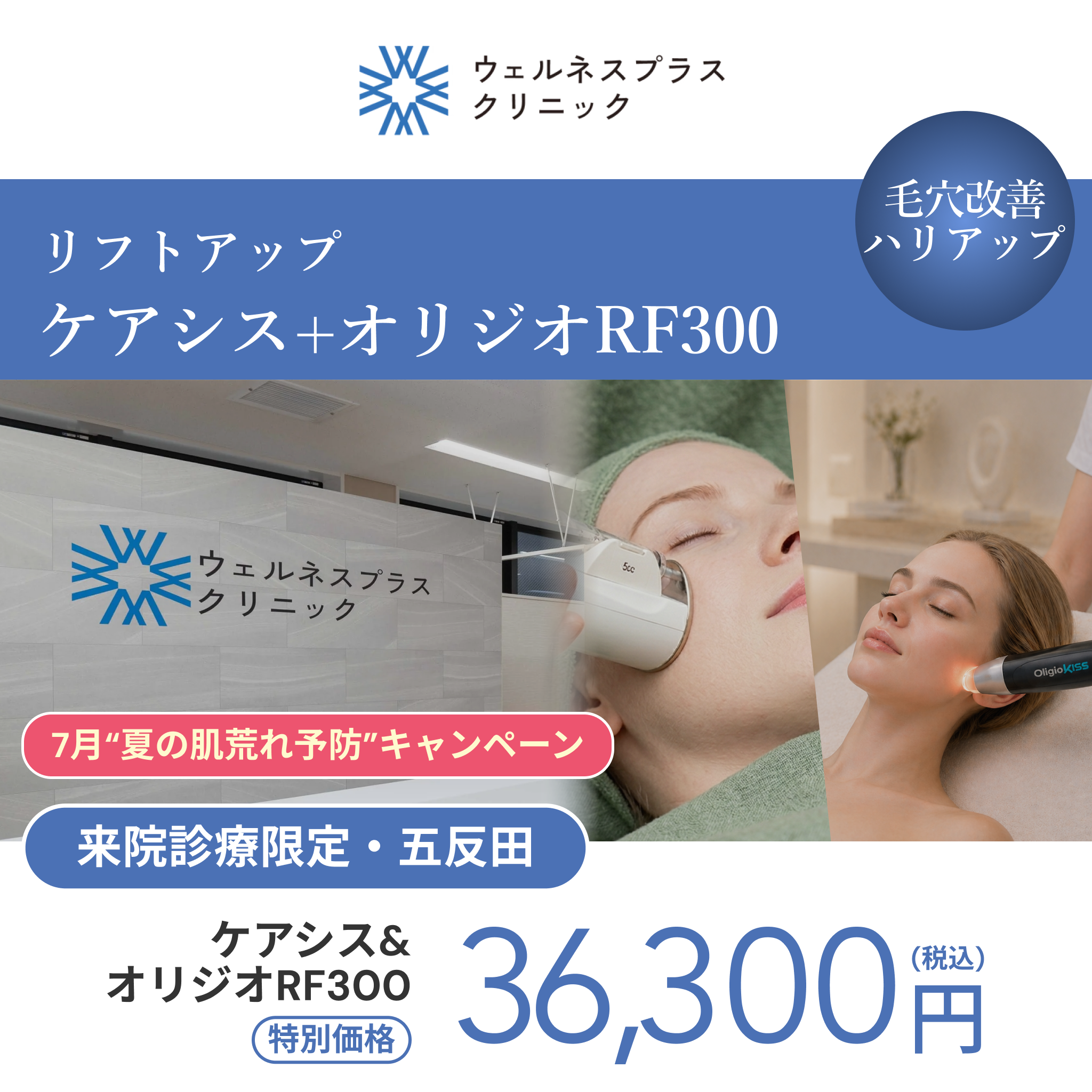 7月“夏の肌荒れ予防”キャンペーン｜オリジオRF300shot＋ケアシス【Wellness Plus Clinic】