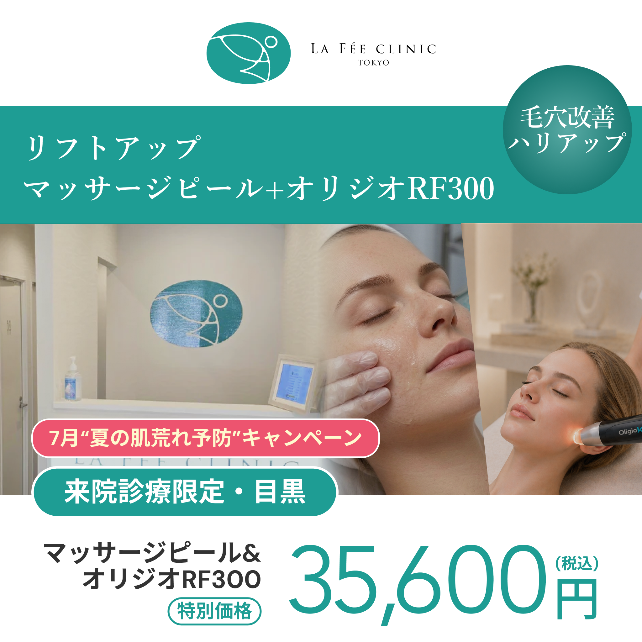 7月“夏の肌荒れ予防”キャンペーン｜マッサージピール＋オリジオRF300shot【La Fée Clinic】