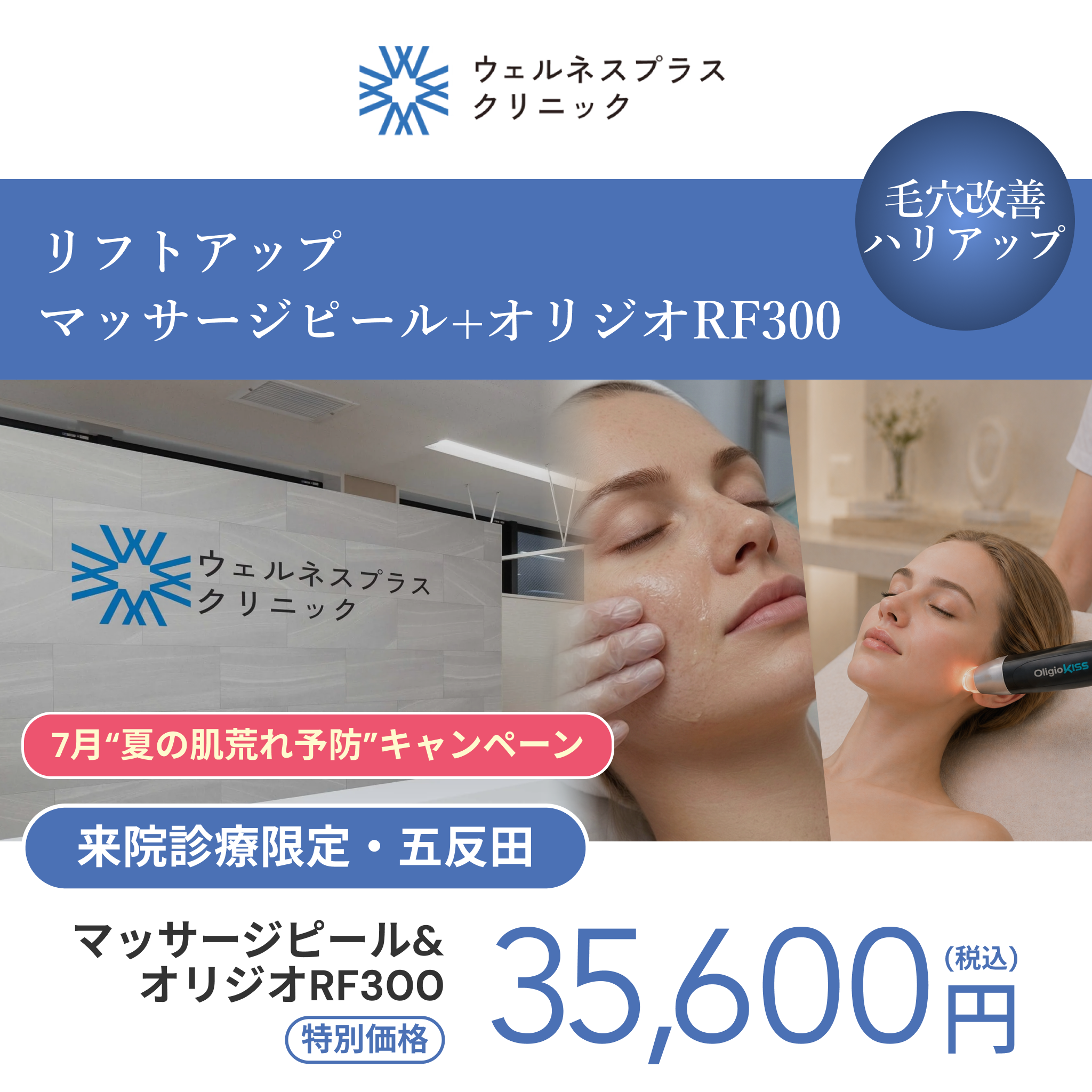 7月“夏の肌荒れ予防”キャンペーン｜マッサージピール＋オリジオRF300shot【Wellness Plus Clinic】